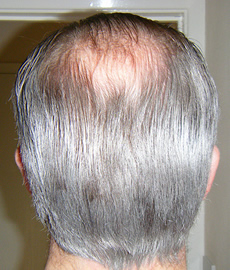 gray balding man