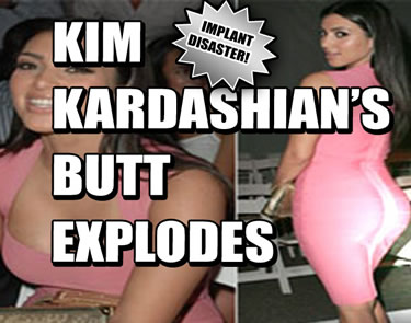 Kardashian butt